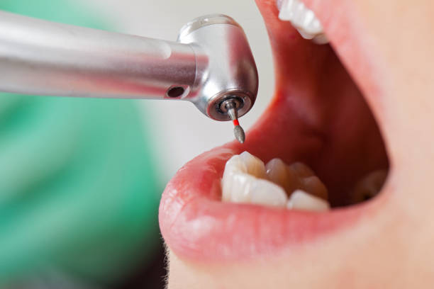 Best Mobile Emergency Dentist in Nichols Hills, OK